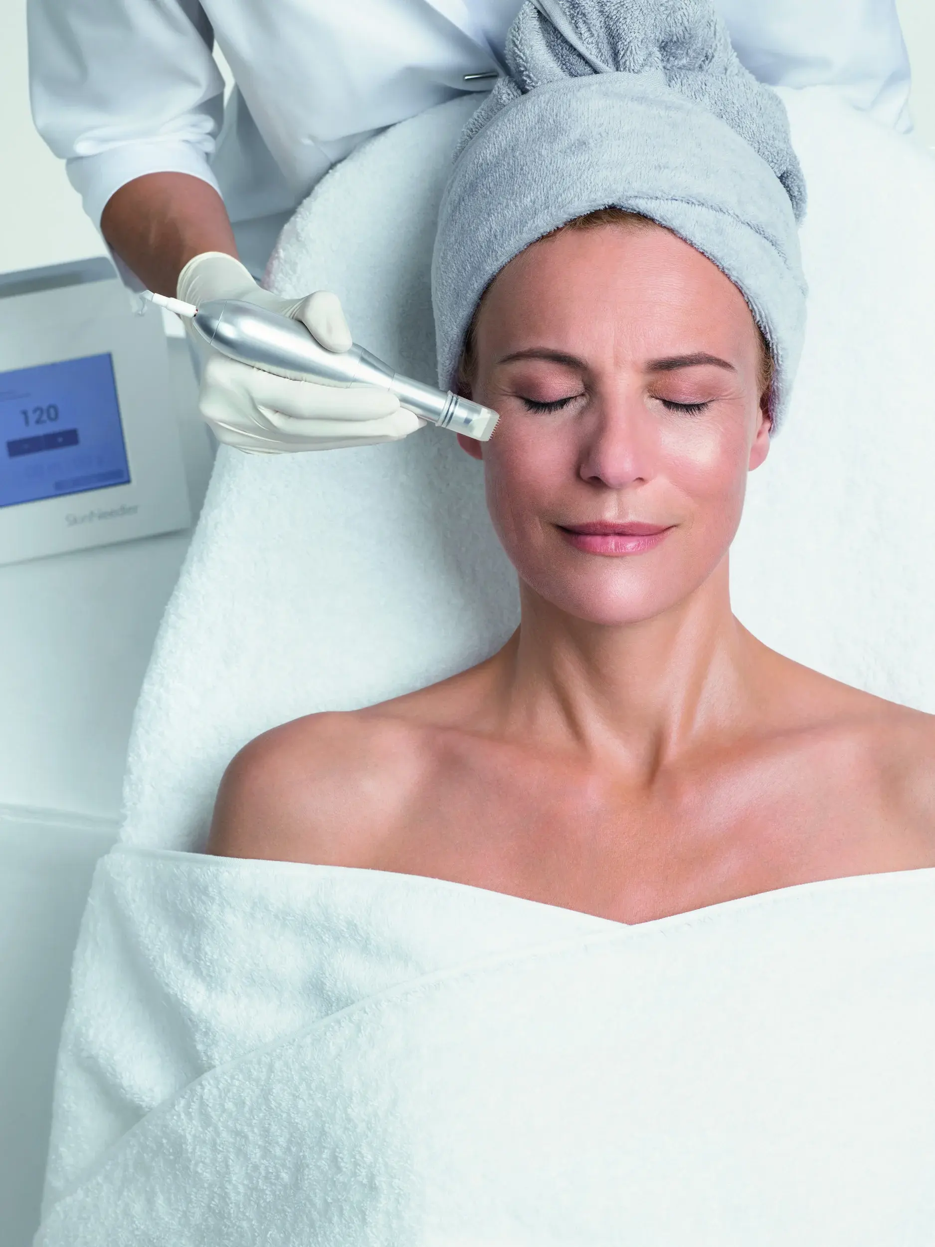 Microneedling mit dem SkinNeedler im House of Shido